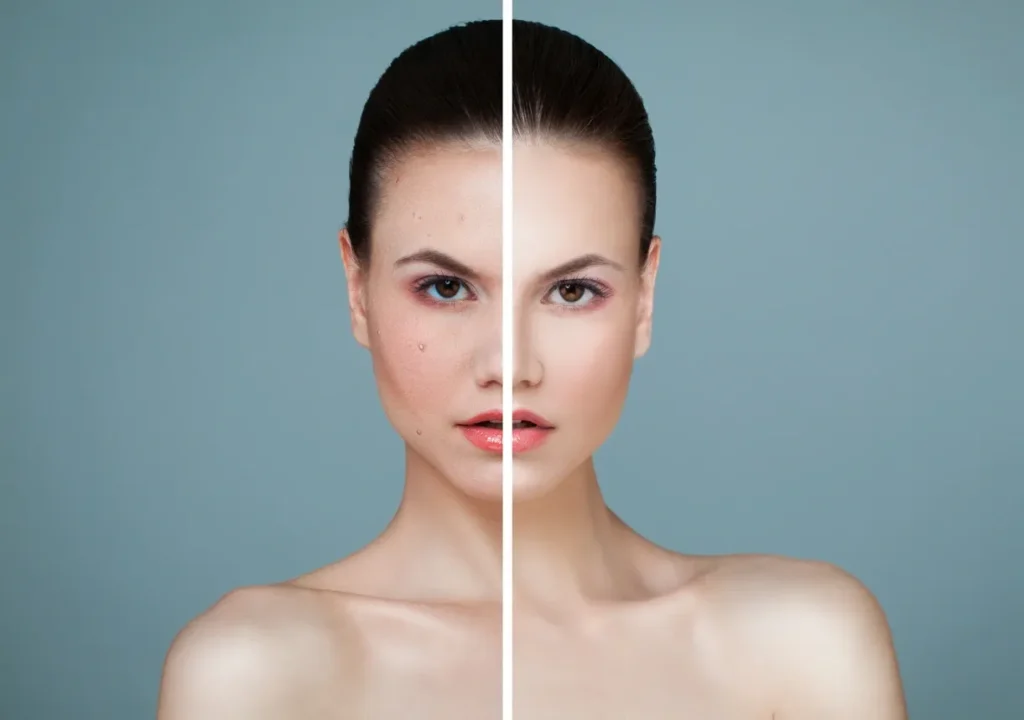 Split image showing a woman's face with and without makeup.